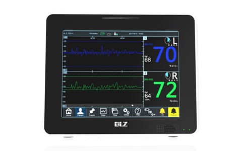 腦組織氧飽和度監測儀
