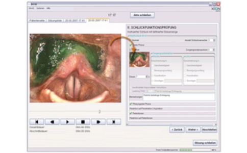 嗓音分析軟件 嗓音分析軟件