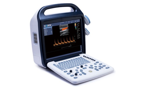 超聲診斷儀 超聲診斷儀