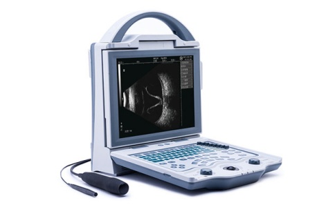 超聲診斷儀