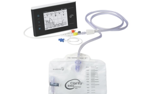 智能尿量監測儀Clarity RMS