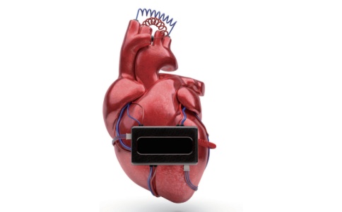 羅氏心臟標志物檢測儀cobas h 232