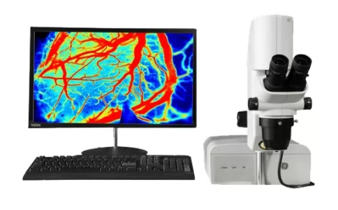 玉研激光散斑血流成像儀HR PRO