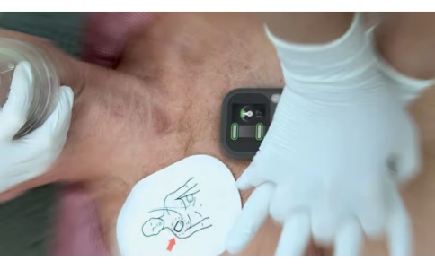 挪度心肺復蘇術反饋CPRmeter? 2