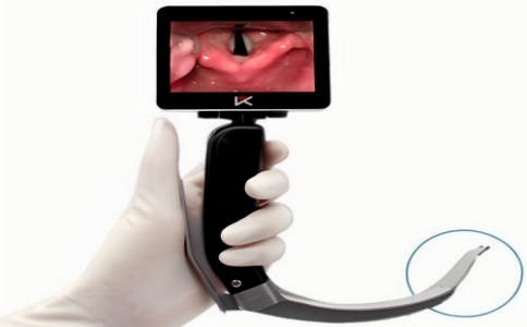 可視喉鏡 07-17-2025.jpg 可視喉鏡 07-17-2025.jpg